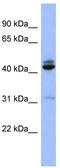 SH3 Domain Containing GRB2 Like 1, Endophilin A2 antibody, TA342206, Origene, Western Blot image 