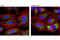 Sequestosome 1 antibody, 8833S, Cell Signaling Technology, Immunofluorescence image 