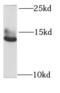 GATE-16 antibody, FNab03277, FineTest, Western Blot image 