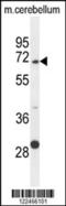 Glypican-5 antibody, 55-332, ProSci, Western Blot image 