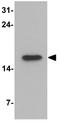Cannabinoid Receptor Interacting Protein 1 antibody, GTX31534, GeneTex, Western Blot image 