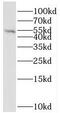 Serine/Threonine Kinase 17a antibody, FNab08326, FineTest, Western Blot image 