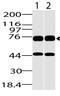 DEAD-Box Helicase 18 antibody, A10977, Boster Biological Technology, Western Blot image 