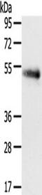 Solute Carrier Family 7 Member 5 antibody, TA351714, Origene, Western Blot image 