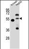 Nitric Oxide Synthase Trafficking antibody, PA5-48643, Invitrogen Antibodies, Western Blot image 