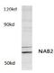 NGFI-A-binding protein 2 antibody, AP01179PU-N, Origene, Western Blot image 