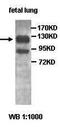 Pre-MRNA Processing Factor 4B antibody, orb77610, Biorbyt, Western Blot image 