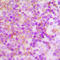 Neutrophil cytosol factor 4 antibody, LS-C356208, Lifespan Biosciences, Immunohistochemistry paraffin image 
