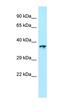 Chaperonin Containing TCP1 Subunit 2 antibody, orb331228, Biorbyt, Western Blot image 