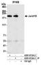 Lysine-specific demethylase 5B antibody, A301-813A, Bethyl Labs, Immunoprecipitation image 