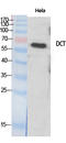 Dopachrome Tautomerase antibody, A01830-1, Boster Biological Technology, Western Blot image 