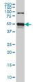 Serine/Threonine Kinase 38 antibody, H00011329-M02, Novus Biologicals, Western Blot image 