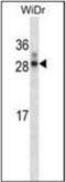 Homeobox A7 antibody, orb313904, Biorbyt, Western Blot image 