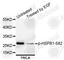 Heat Shock Protein Family B (Small) Member 1 antibody, AP0041, ABclonal Technology, Western Blot image 