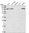 Phosphoinositide-3-Kinase Regulatory Subunit 5 antibody, HPA052412, Atlas Antibodies, Western Blot image 