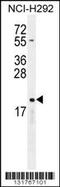 Cytochrome B-245 Alpha Chain antibody, 56-245, ProSci, Western Blot image 