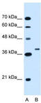 Ring Finger Protein 146 antibody, TA330479, Origene, Western Blot image 