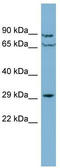 CutC Copper Transporter antibody, TA345086, Origene, Western Blot image 