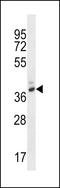 Pepsin A antibody, LS-C163541, Lifespan Biosciences, Western Blot image 