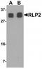 RILP-like protein 2 antibody, TA320134, Origene, Western Blot image 