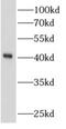 AlkB Homolog 1, Histone H2A Dioxygenase antibody, FNab00311, FineTest, Western Blot image 