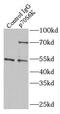 Ribosomal Protein S6 Kinase B1 antibody, FNab06090, FineTest, Immunoprecipitation image 
