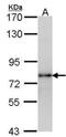Luteinizing hormone receptor antibody, NBP2-53094, Novus Biologicals, Western Blot image 
