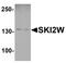 Helicase SKI2W antibody, A04982, Boster Biological Technology, Western Blot image 