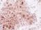 Sequestosome 1 antibody, A302-856A, Bethyl Labs, Immunohistochemistry frozen image 