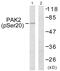 P21 (RAC1) Activated Kinase 2 antibody, PA5-38381, Invitrogen Antibodies, Western Blot image 