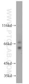 Dihydropyrimidinase Like 2 antibody, 14686-1-AP, Proteintech Group, Western Blot image 