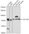 Solute Carrier Family 13 Member 4 antibody, A13300, Boster Biological Technology, Western Blot image 