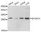 Exosome Component 4 antibody, STJ113618, St John