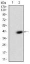 Insulin Like Growth Factor Binding Protein 7 antibody, NBP2-37314, Novus Biologicals, Western Blot image 
