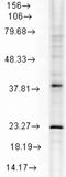 Heat Shock Protein Family B (Small) Member 8 antibody, NBP1-48303, Novus Biologicals, Western Blot image 
