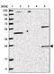 Stanniocalcin 1 antibody, PA5-54924, Invitrogen Antibodies, Western Blot image 