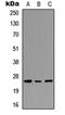 Peroxisomal Biogenesis Factor 11 Gamma antibody, orb256746, Biorbyt, Western Blot image 