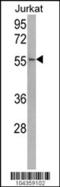 Ubiquitin Specific Peptidase 22 antibody, 61-113, ProSci, Western Blot image 