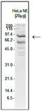 Structure Specific Recognition Protein 1 antibody, TA347298, Origene, Western Blot image 