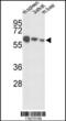 Insulin Like Growth Factor Binding Protein Acid Labile Subunit antibody, 62-941, ProSci, Western Blot image 