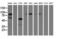 Phosphoinositide-3-Kinase Adaptor Protein 1 antibody, GTX83898, GeneTex, Western Blot image 