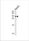 NK6 Homeobox 3 antibody, TA324622, Origene, Western Blot image 