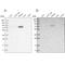 Leucine Rich Repeat Containing 45 antibody, PA5-55175, Invitrogen Antibodies, Western Blot image 