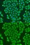 Centromere Protein K antibody, GTX65896, GeneTex, Immunocytochemistry image 