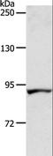 Acyl-CoA Dehydrogenase Family Member 11 antibody, LS-C404418, Lifespan Biosciences, Western Blot image 