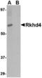 Mex-3 RNA Binding Family Member A antibody, TA306671, Origene, Western Blot image 