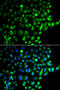 Ras-related protein Rab-31 antibody, STJ29642, St John