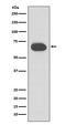 Keratin 1 antibody, M01639-1, Boster Biological Technology, Western Blot image 