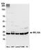 Ribosomal Protein L18a antibody, A305-029A, Bethyl Labs, Western Blot image 