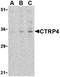 C1q And TNF Related 4 antibody, ADI-905-717-100, Enzo Life Sciences, Western Blot image 